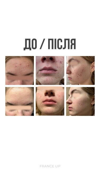 Результати &mdash; Фото 2