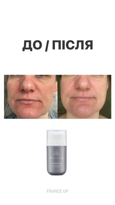 Результати &mdash; Фото 3