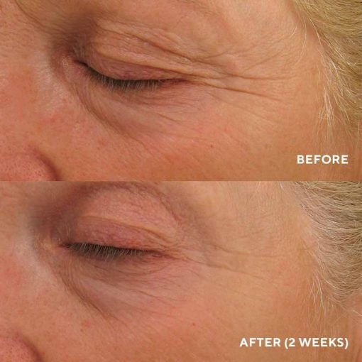 HydroPeptide Eye Authority 15ml Крем для комплексного омолодження зони навколо очей &mdash; Фото 3