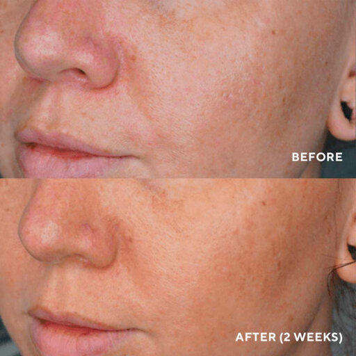 HydroPeptide Lumapro-C Skin Brightening Pigment Corrector 30ml Сироватка для усунення пігментації &mdash; Фото 2